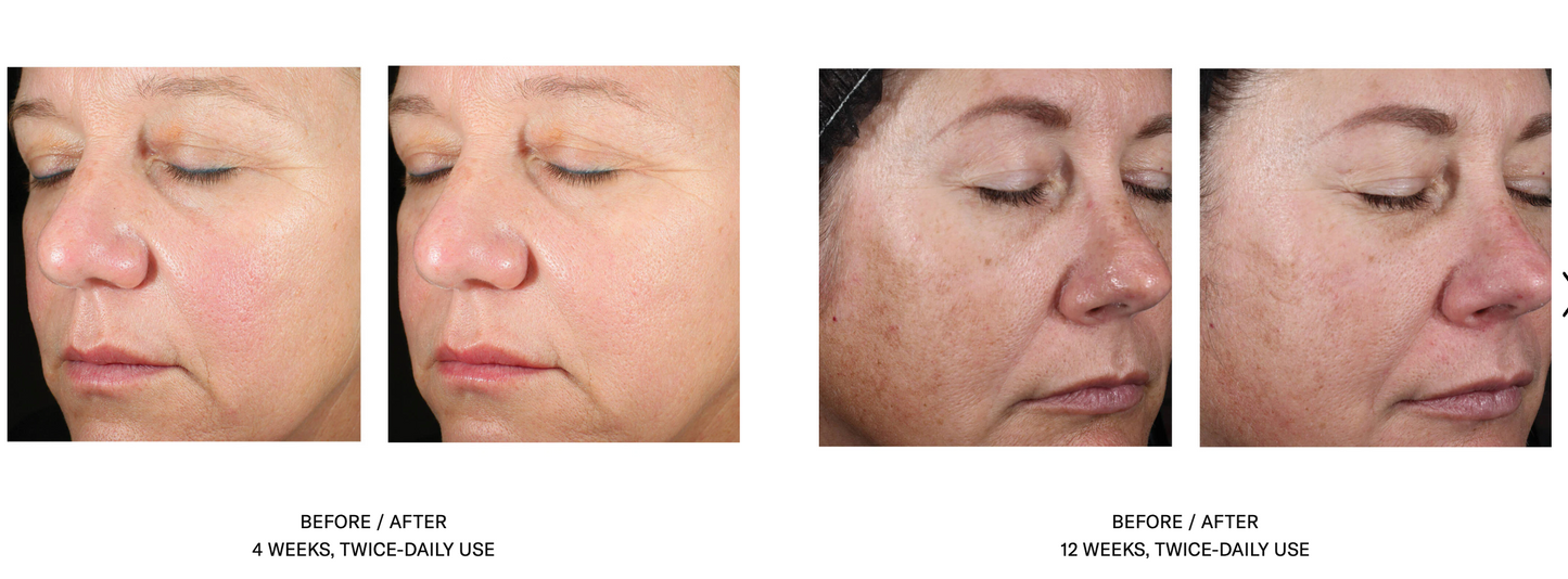 Alto Advanced Antioxidant Defense and Repair Serum