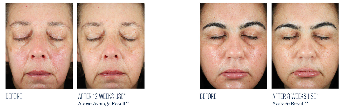 BioRewind Skin Health Dietary Supplement