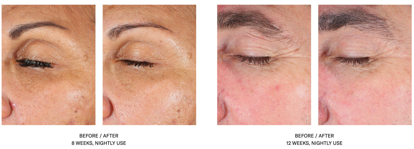 EyeMax AlphaRet Overnight Cream