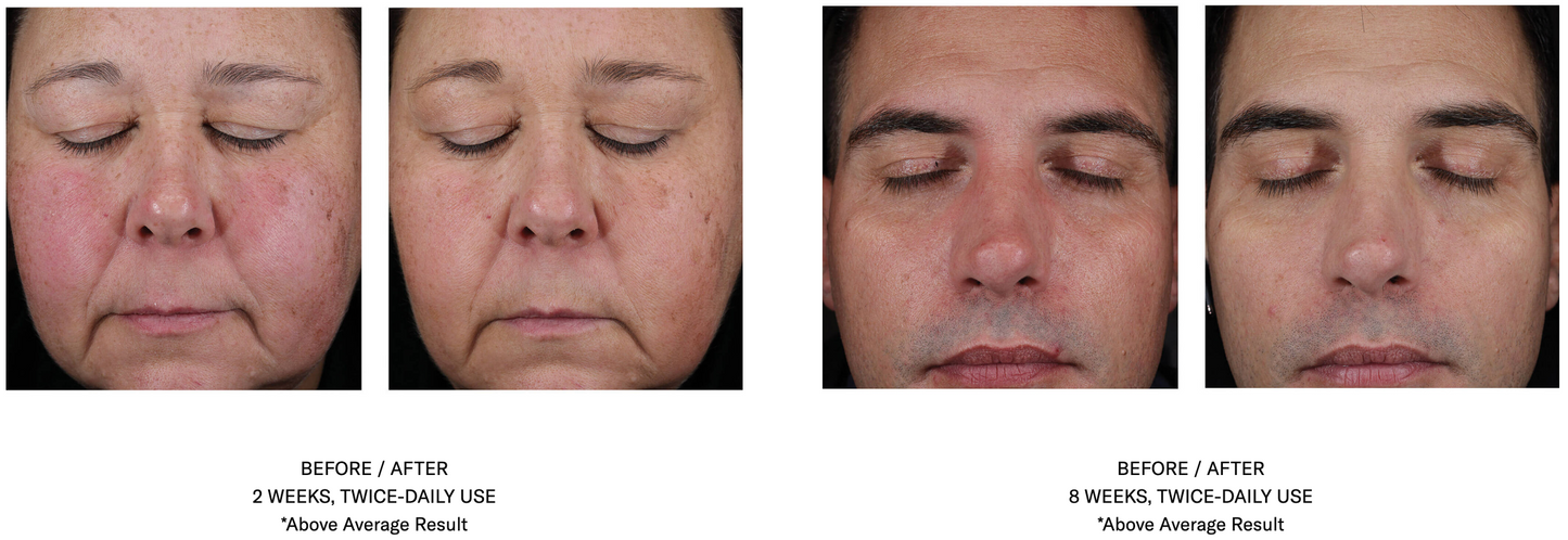 Mystro Active Balance Serum