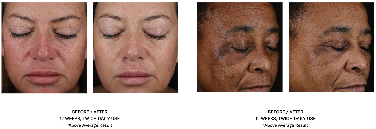 Mystro Active Balance Serum