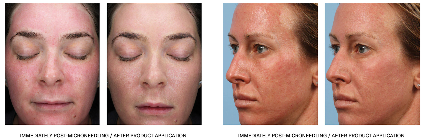 sunbetter TONE SMART SPF 68 Sunscreen Compact