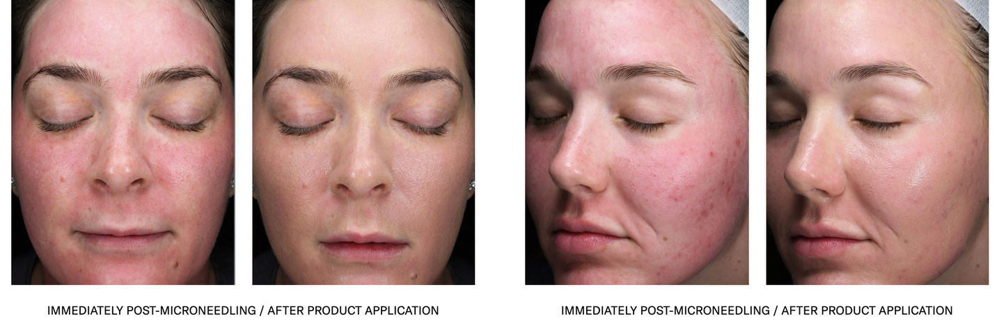 sunbetter TONE SMART SPF 75 Sunscreen Lotion