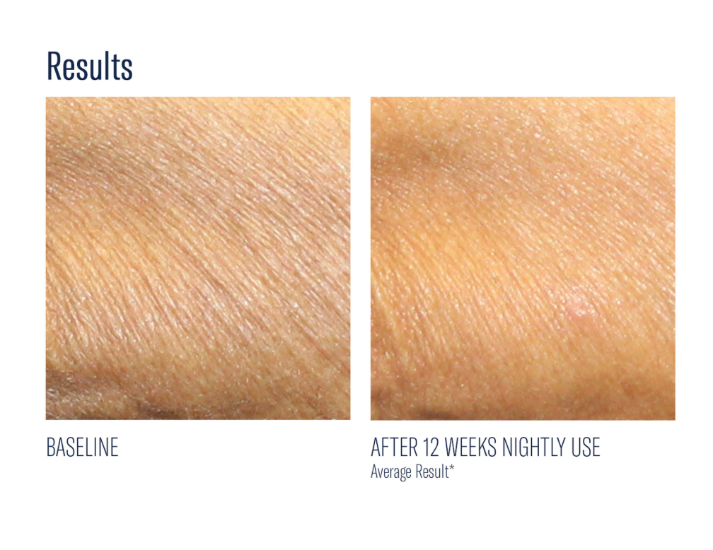 AlphaRet Body Overnight Cream