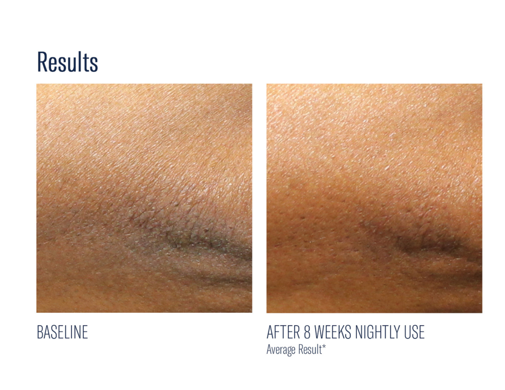 AlphaRet Body Overnight Cream