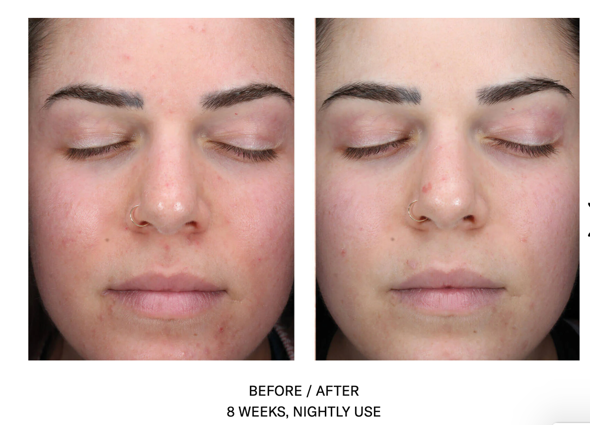 AlphaRet Clearing Serum