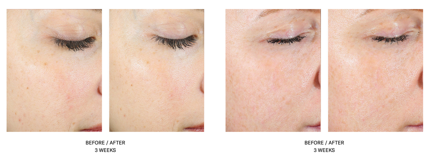 AlphaRet Exfoliating Facial Pads - 30 count