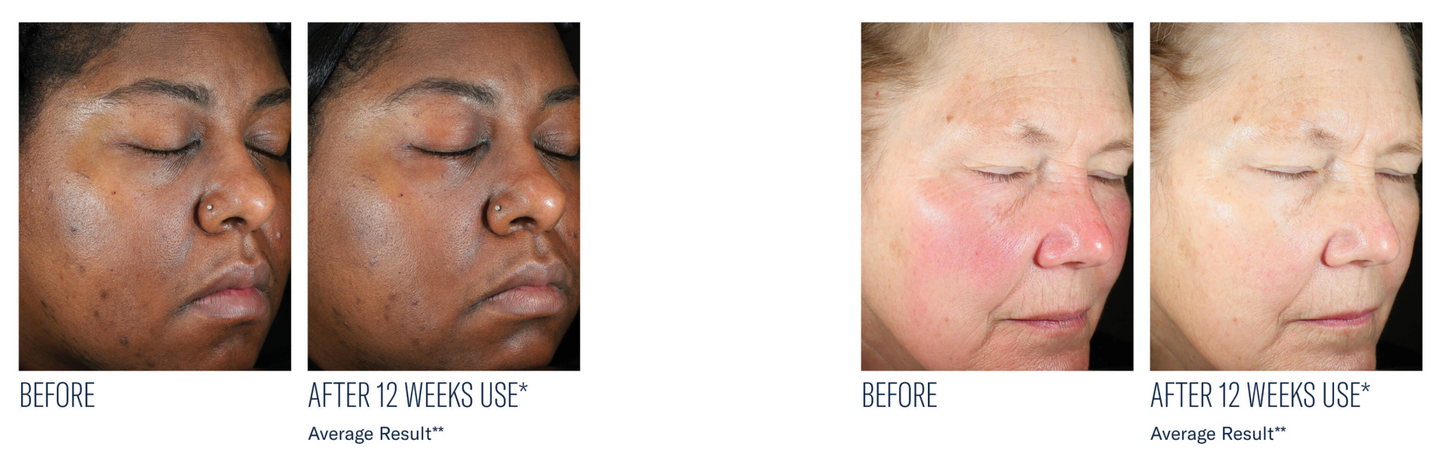 Even Intensive Skin Tone Correcting Serum