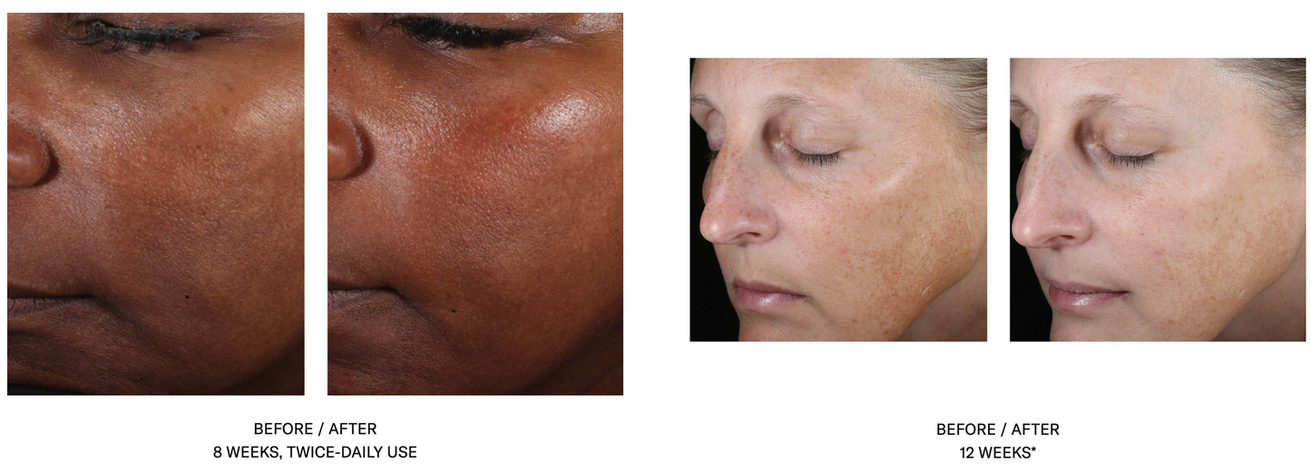 Even Tone Correcting Serum