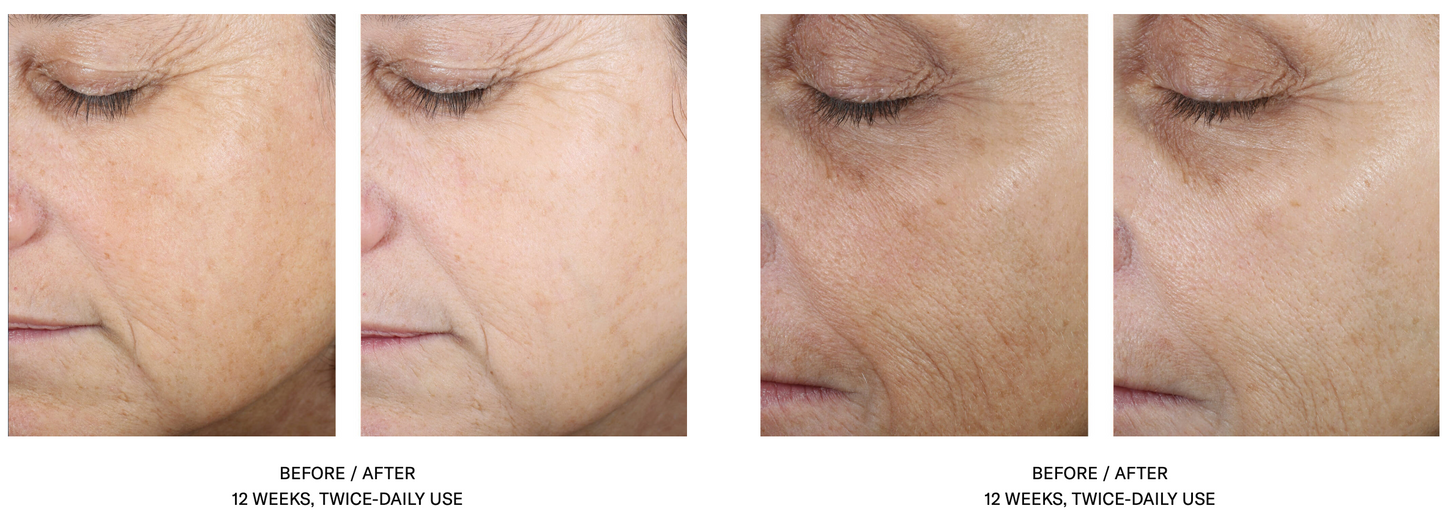 Even Tone Correcting Serum