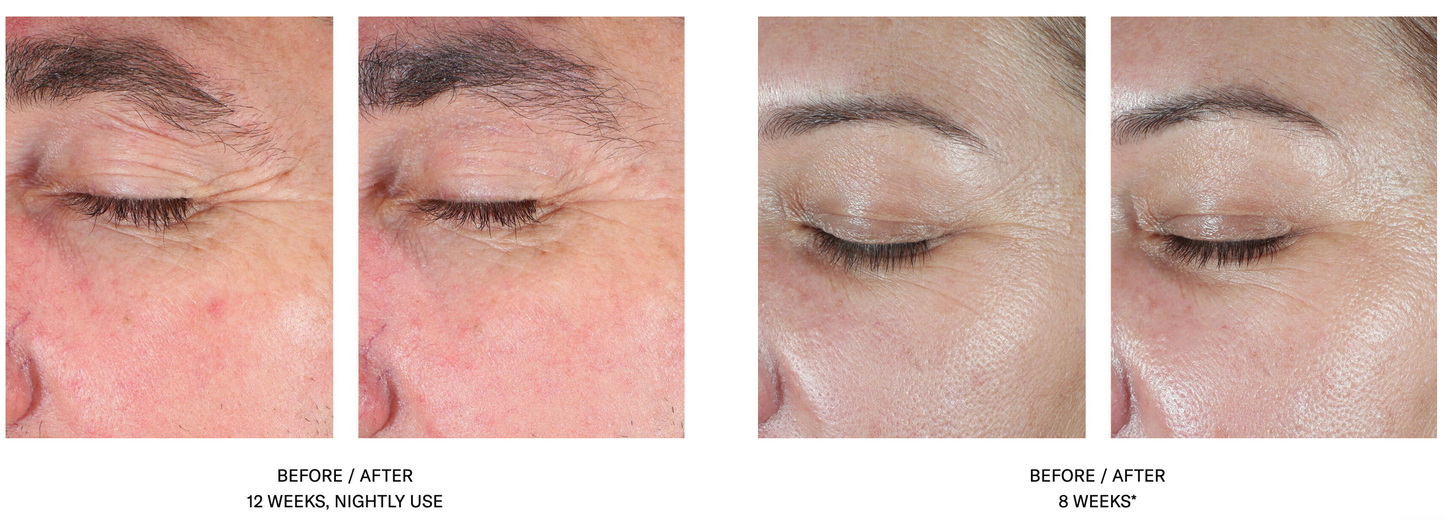 EyeMax AlphaRet Overnight Cream