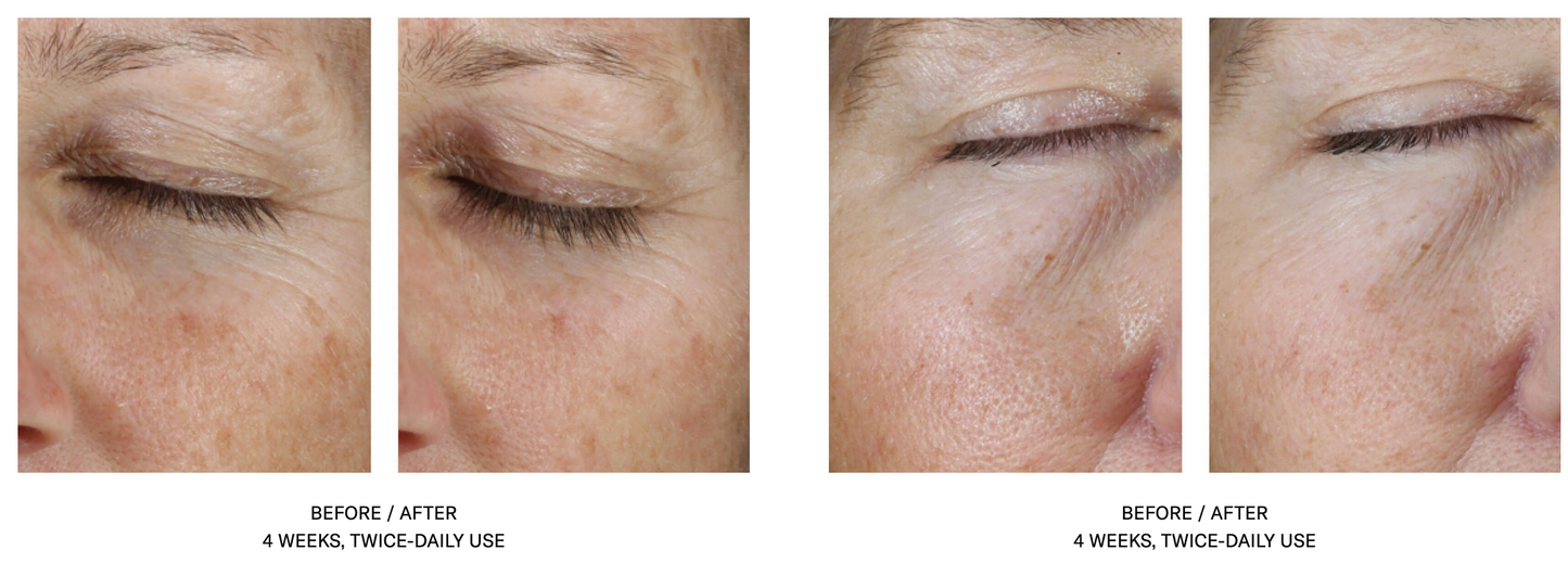 Instant Effect Gel EYE