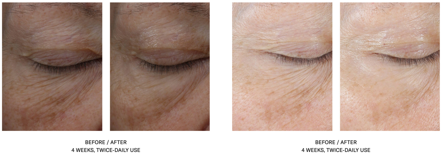 InterFuse Treatment Cream EYE