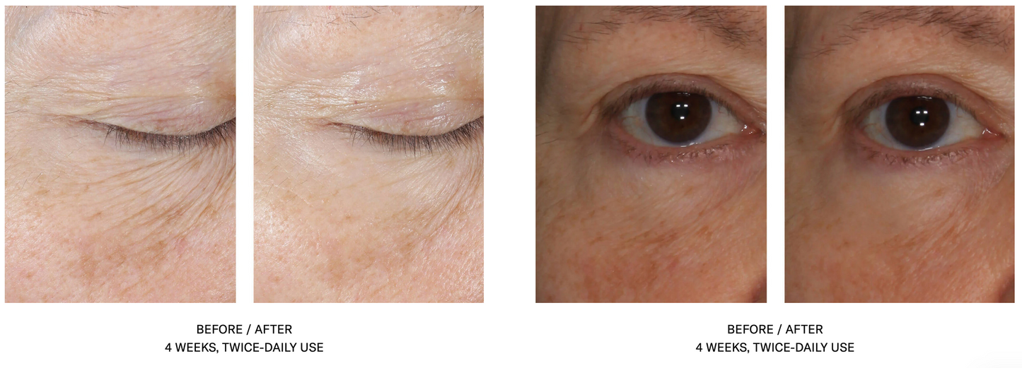 InterFuse Treatment Cream EYE