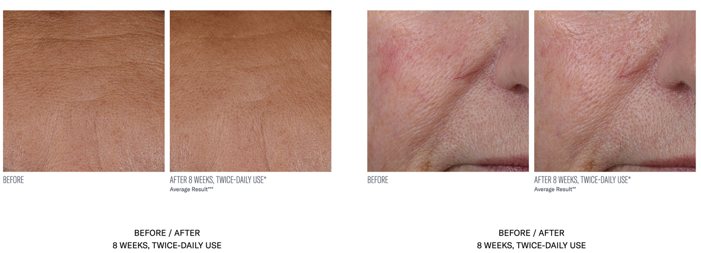 InterFuse Treatment Cream Face and Neck