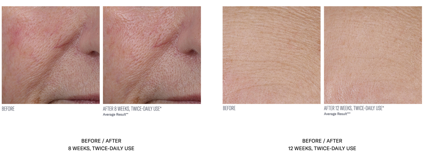 InterFuse Treatment Cream Face and Neck