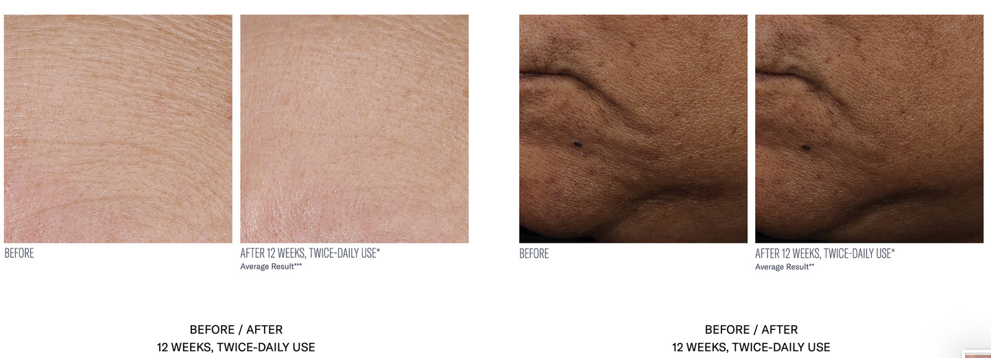 InterFuse Treatment Cream Face and Neck