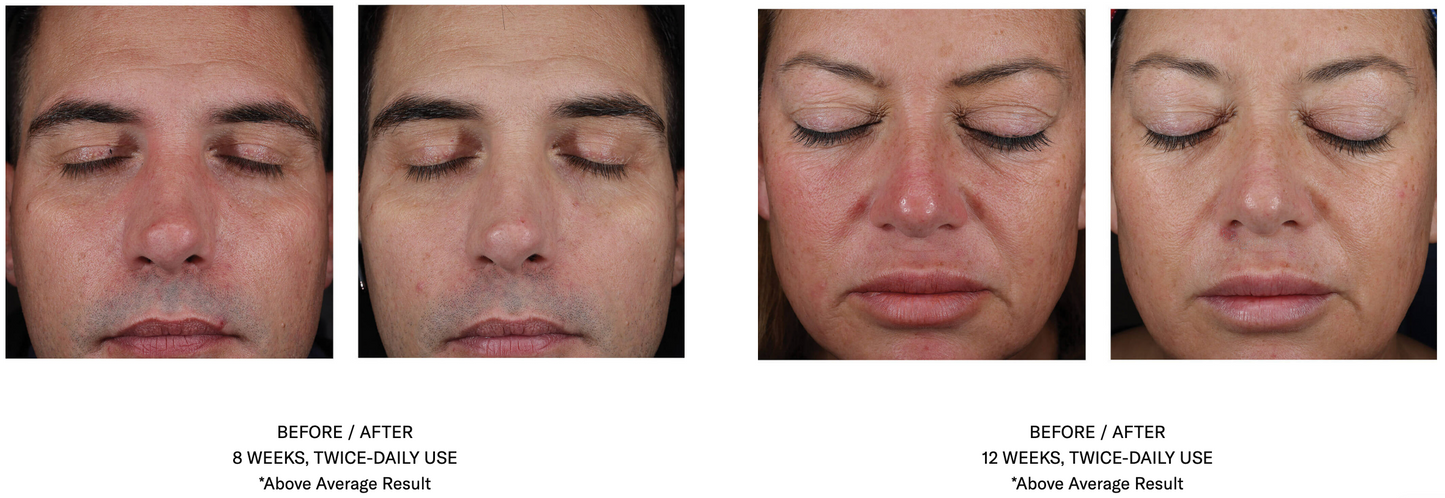 Mystro Active Balance Serum