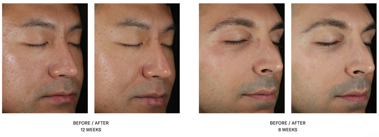 Solo Hydrating Defense Men