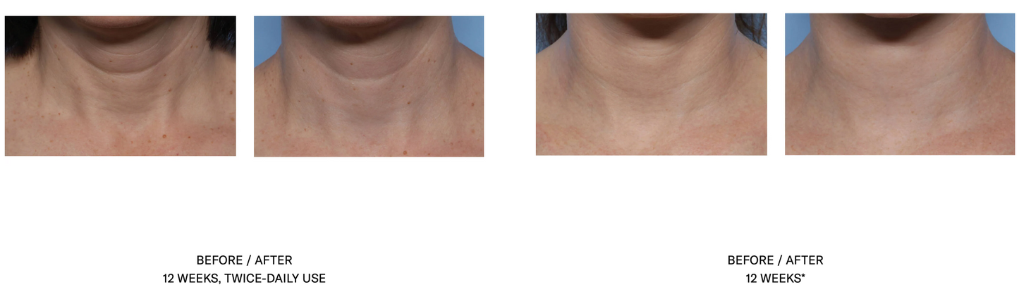 Techno Neck Perfecting Cream